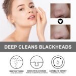Blackhead Cleansing Cream Exfoliating, Cleaning And Repairing Pores Solve Skin Oil, Blackhead And Acne Problems Peel-off Nose Patch - Image 4