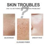 Blackhead Cleansing Cream Exfoliating, Cleaning And Repairing Pores Solve Skin Oil, Blackhead And Acne Problems Peel-off Nose Patch - Image 10